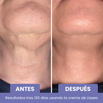 Crema Anti-Edad Cuello y Escote