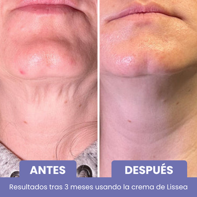 Crema Anti-Edad Cuello y Escote