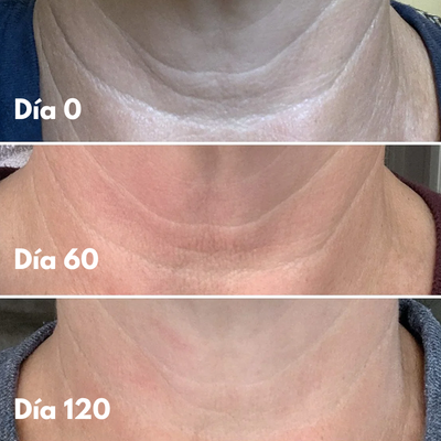 Crema Anti-Edad Cuello y Escote
