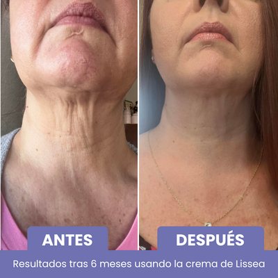 Crema Anti-Edad Cuello y Escote
