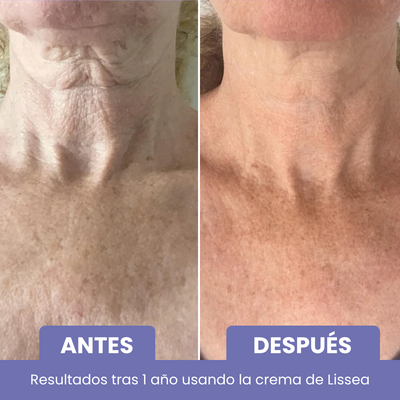 Crema Anti-Edad Cuello y Escote
