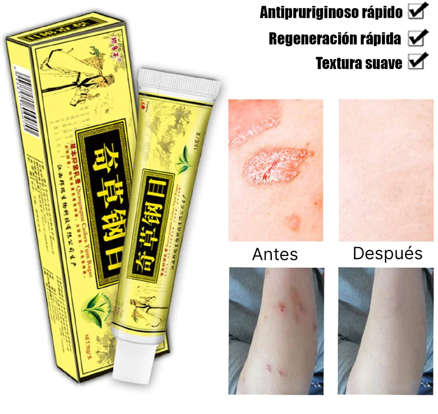 Crema Herbal China -  Natural para Psoriasis y Eccema